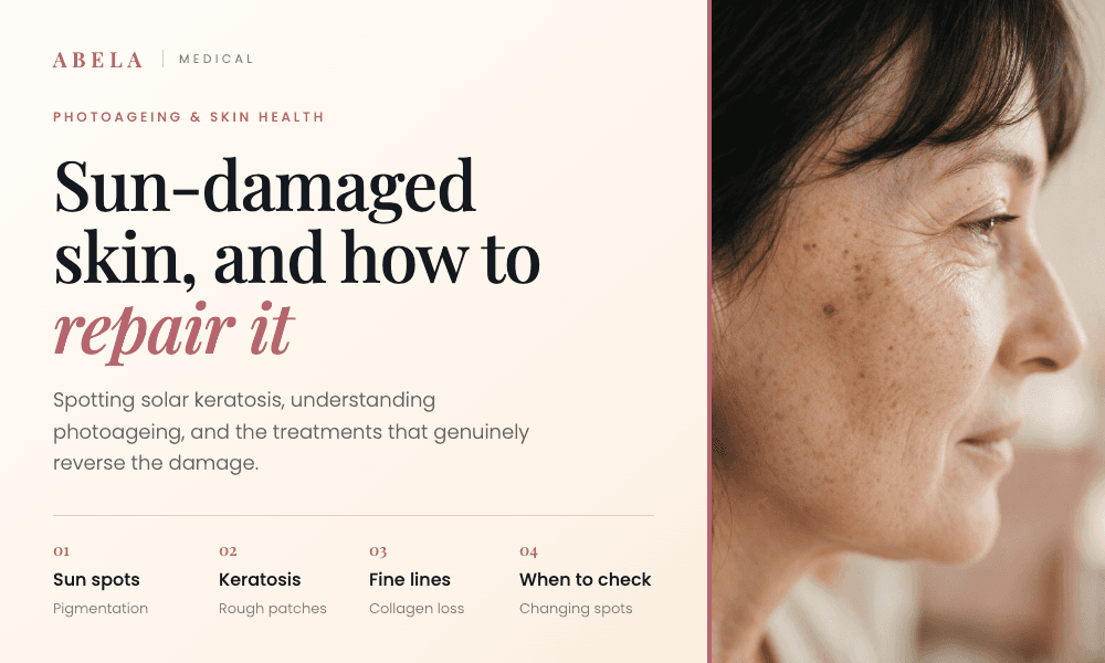 Sun-damaged skin explained by Abela Medical